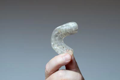 custom mouthguard used to treat sleep apnea