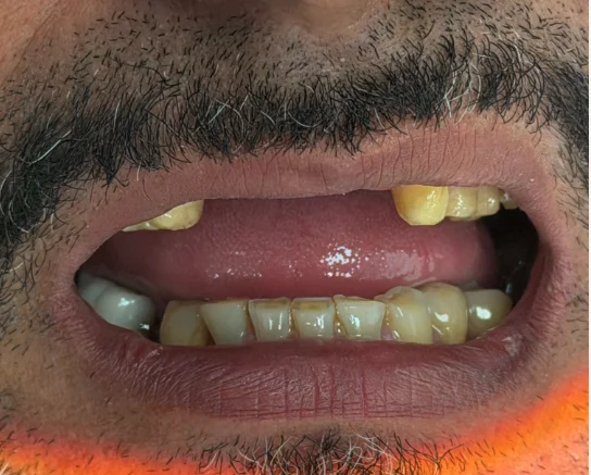 iScreen Shoter - Google Chrome - 260225143413