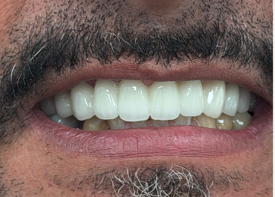 iScreen Shoter - Google Chrome - 260225143455