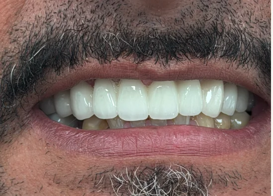 iScreen Shoter - Google Chrome - 260225143455