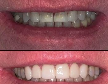 Smile Gallery