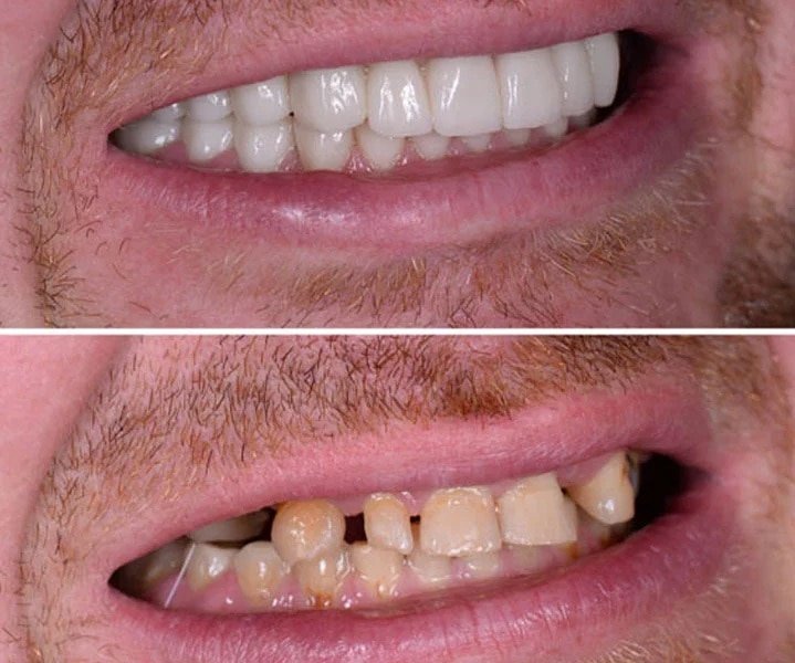 Smile Gallery