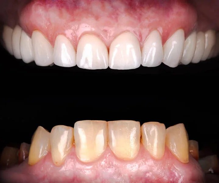 Smile Gallery