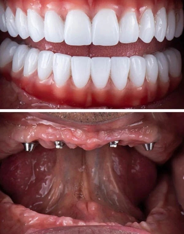 Smile Gallery