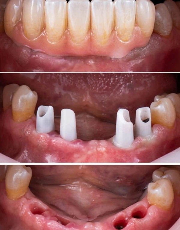 Smile Gallery