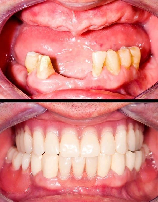 Smile Gallery