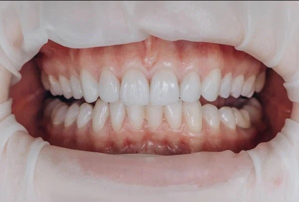 Smile Gallery