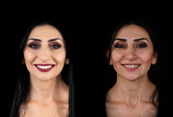 Smile Gallery