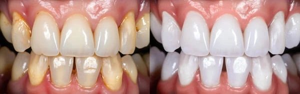Smile Gallery