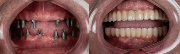 Smile Gallery