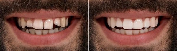 Smile Gallery