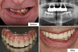 Smile Gallery
