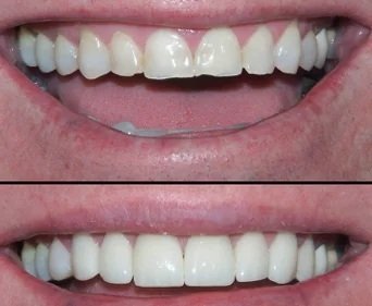 Smile Gallery
