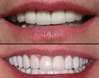 Smile Gallery